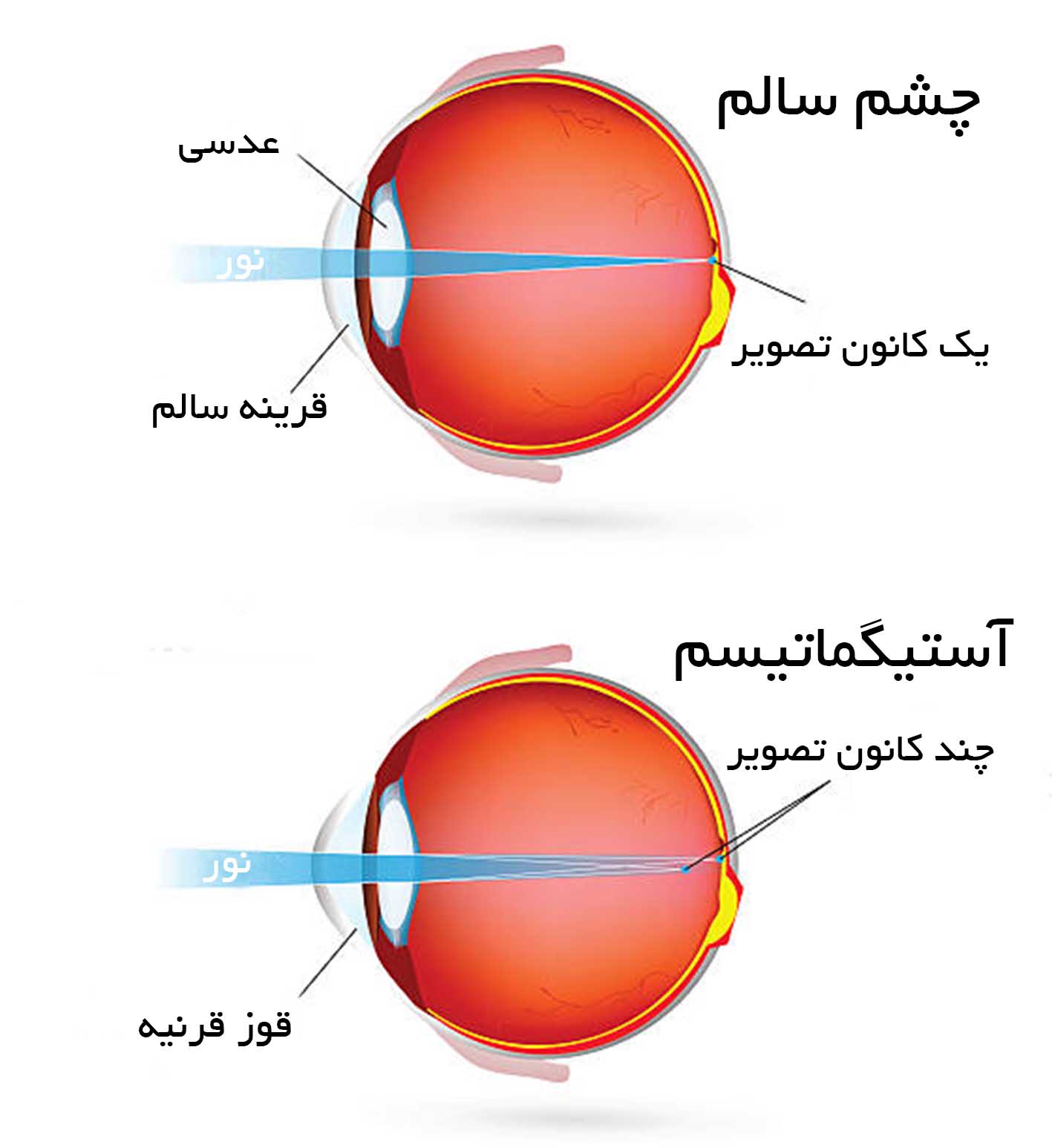 تست آستیگماتیسم آنلاین چشم با چارت مخصوص تشخیص