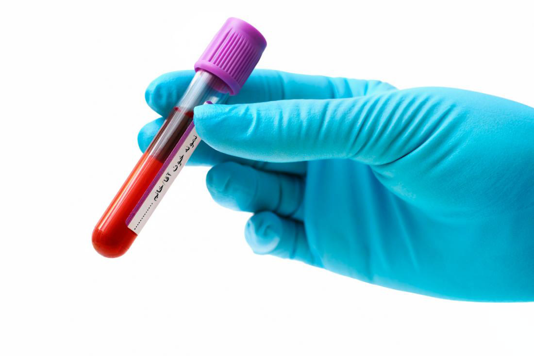 آزمایش خون معاینات طب کار چیست و شامل چیست؟