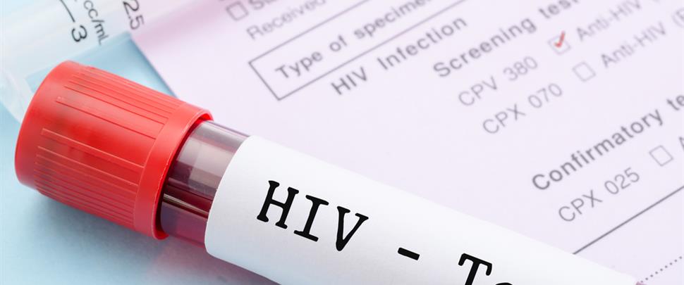 آزمایش ایدز در معاينات بدو استخدام (تامین اجتماعی)