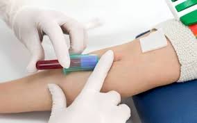 آزمایش خون طب کار چیست و شامل چه مواردی است؟
