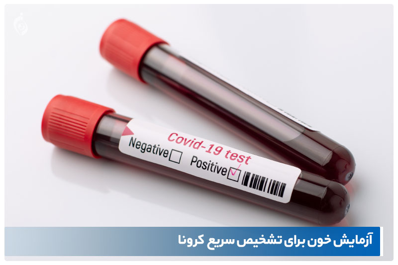 آزمایش خون برای تشخیص سریع کرونا